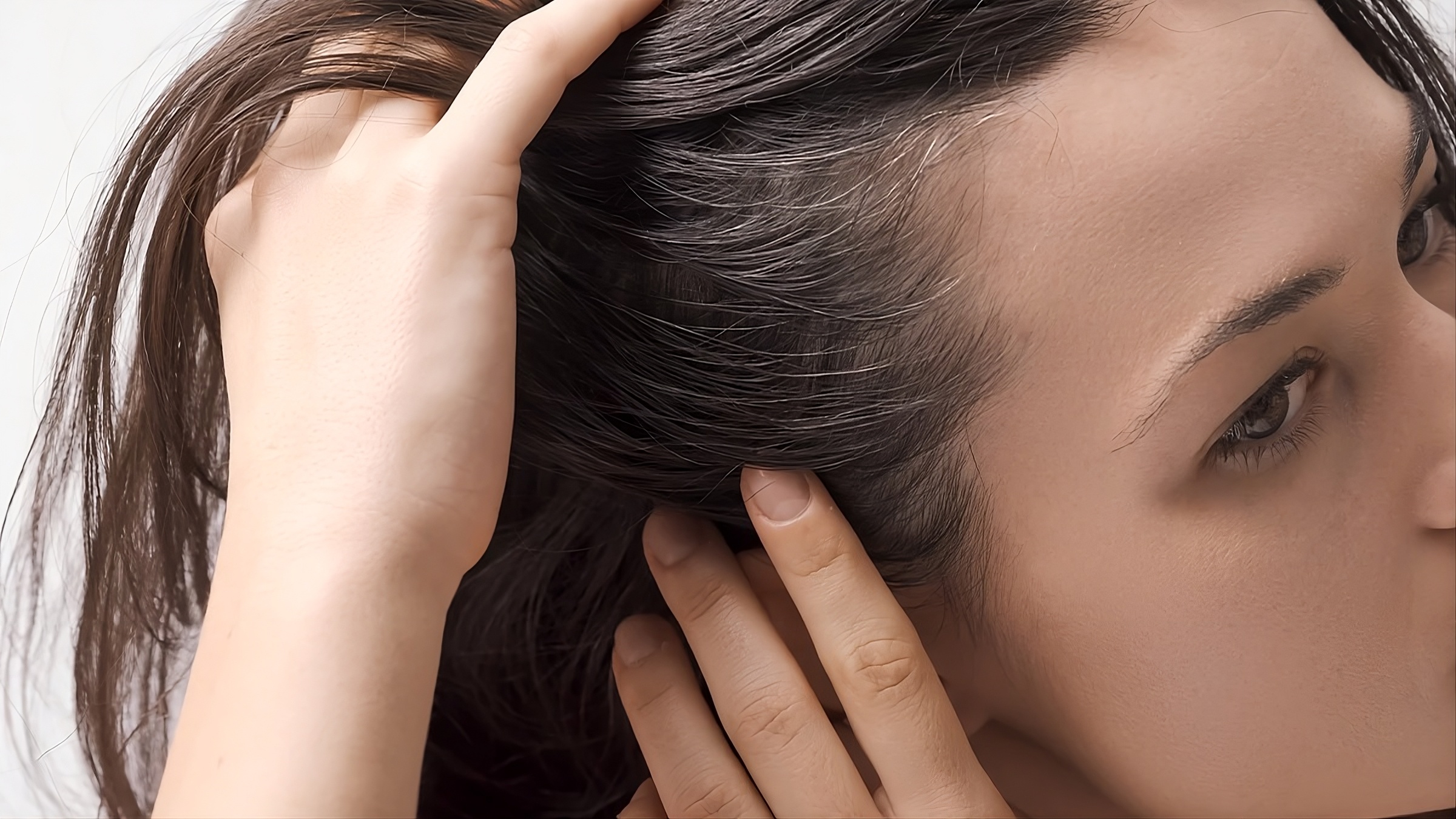 trasplante capilar FUE para mejorar la densidad del cabello